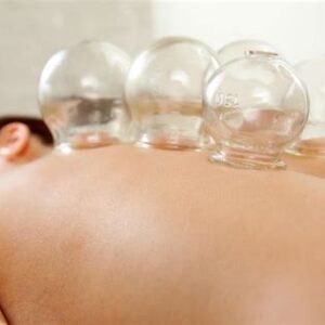 what is cupping